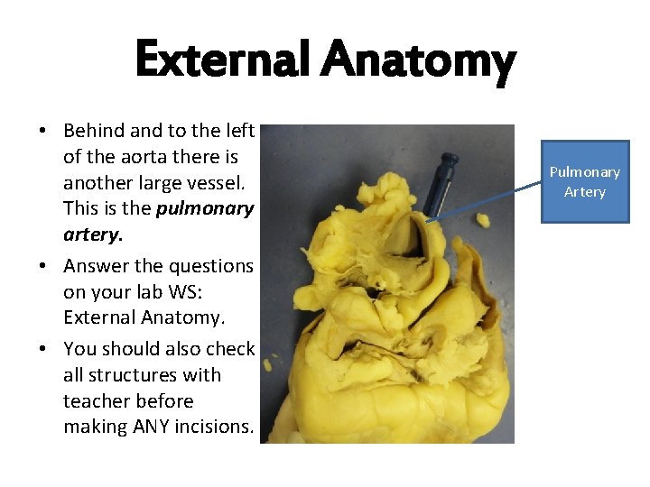 External Anatomy • Behind and to the left of the aorta there is another