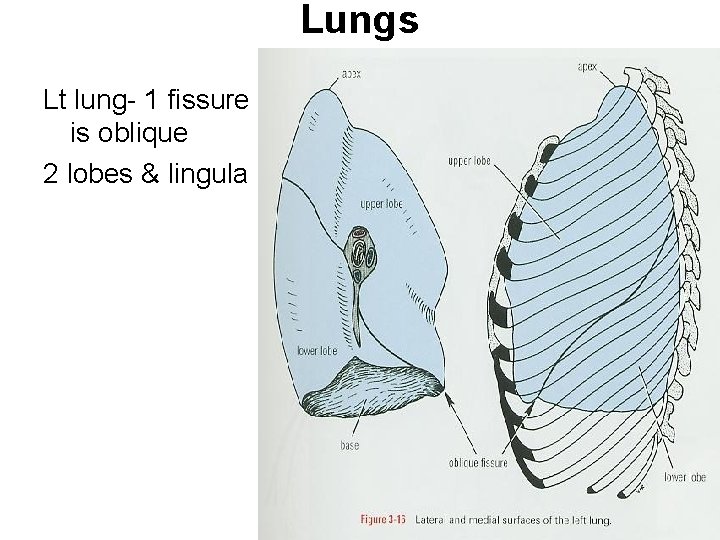 Lungs Lt lung- 1 fissure is oblique 2 lobes & lingula 