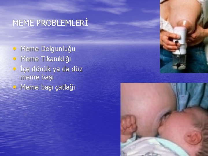 MEME PROBLEMLERİ • Meme Dolgunluğu • Meme Tıkanıklığı • İçe dönük ya da düz