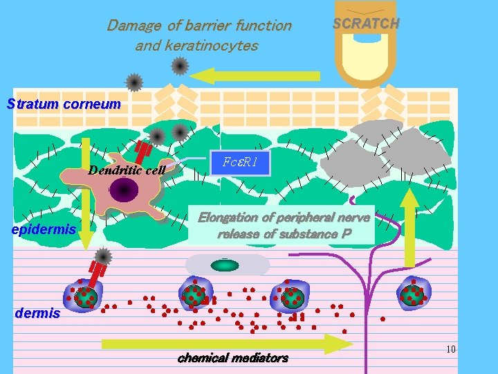 Damage of barrier function and keratinocytes SCRATCH Stratum corneum Dendritic cell epidermis Fce. R