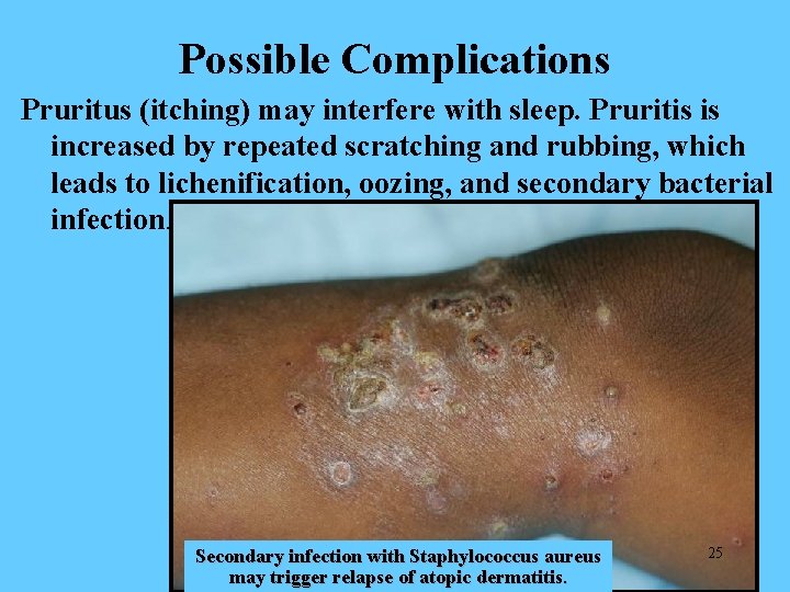 Possible Complications Pruritus (itching) may interfere with sleep. Pruritis is increased by repeated scratching