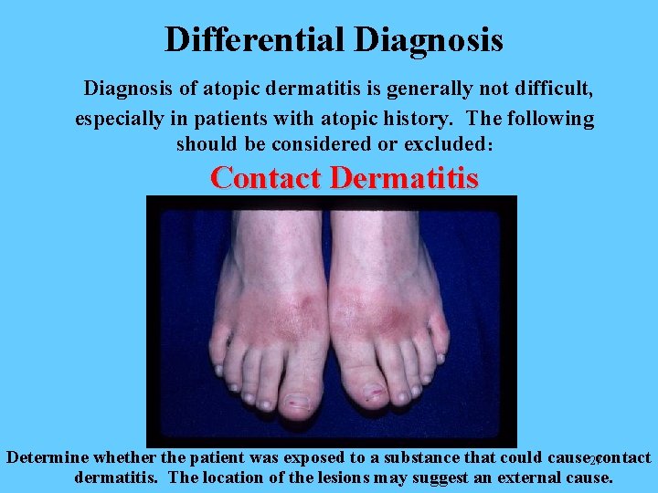 Differential Diagnosis of atopic dermatitis is generally not difficult, especially in patients with atopic