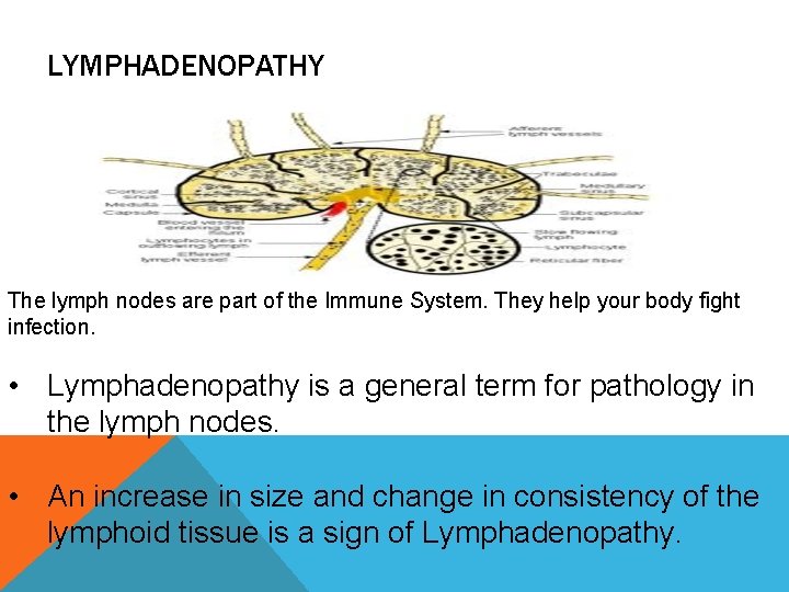 LYMPHADENOPATHY The lymph nodes are part of the Immune System. They help your body