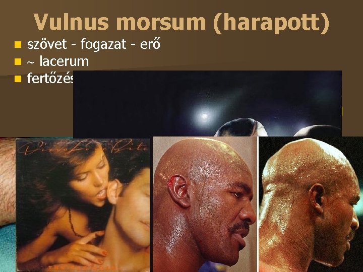 Vulnus morsum (harapott) szövet - fogazat - erő lacerum fertőzésveszély ÁNTSZ felé jelentési kötelezettség