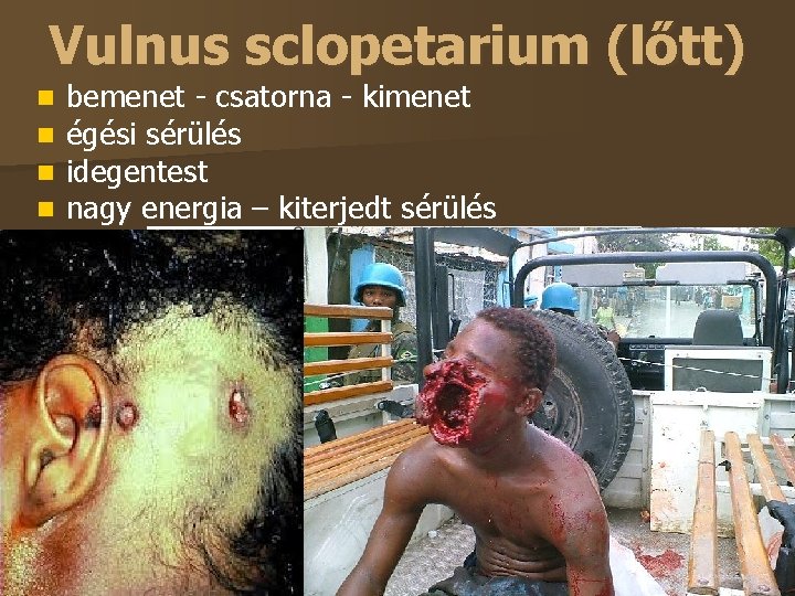 Vulnus sclopetarium (lőtt) bemenet - csatorna - kimenet égési sérülés idegentest nagy energia –