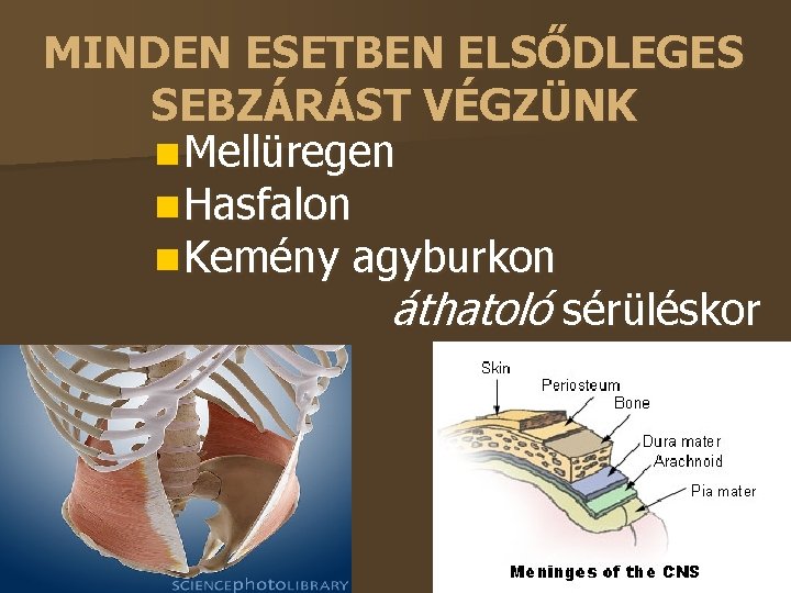 MINDEN ESETBEN ELSŐDLEGES SEBZÁRÁST VÉGZÜNK Mellüregen Hasfalon Kemény agyburkon áthatoló sérüléskor 