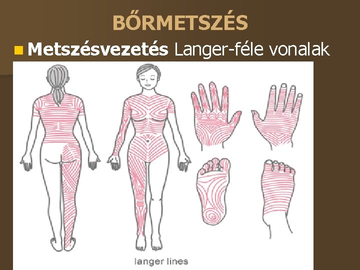 BŐRMETSZÉS Metszésvezetés Langer-féle vonalak – hossz, irány, szél Erek, idegek kímélete Bőrszike 