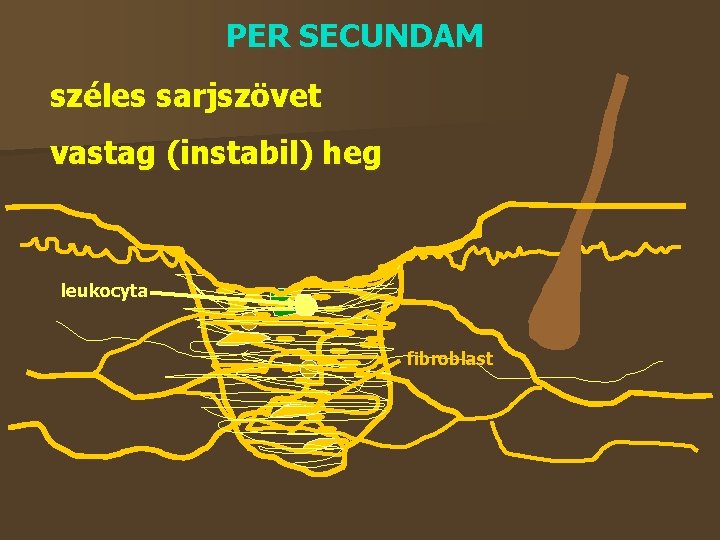 PER SECUNDAM széles sarjszövet vastag (instabil) heg leukocyta fibroblast 