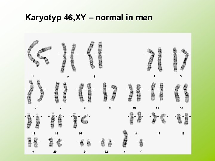 Karyotyp 46, XY – normal in men 