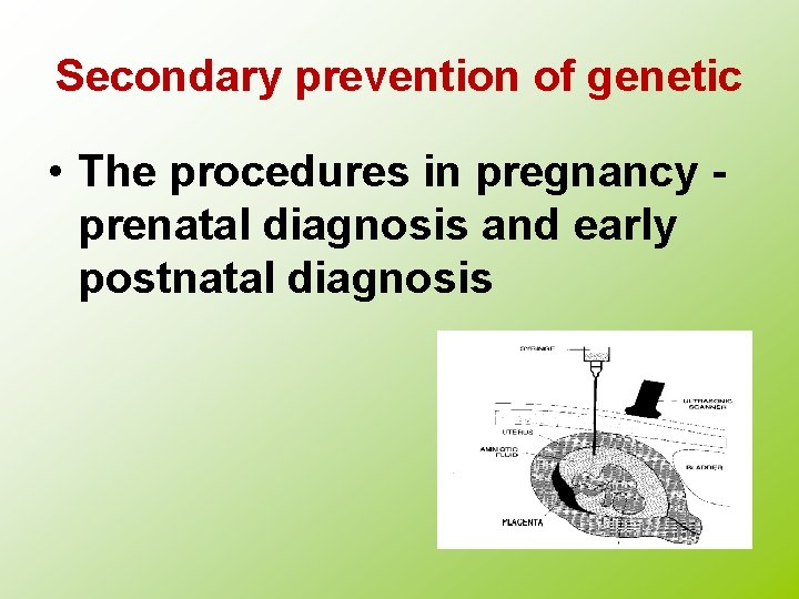 Secondary prevention of genetic • The procedures in pregnancy prenatal diagnosis and early postnatal