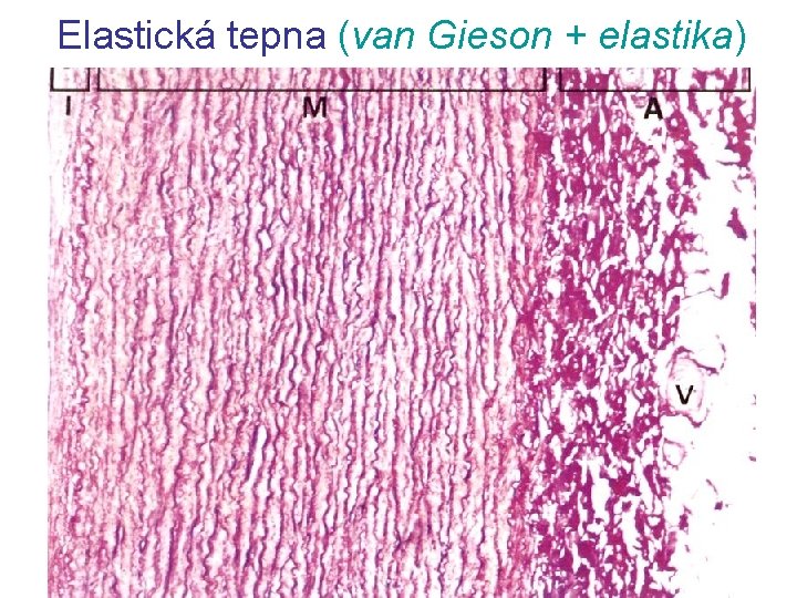 Elastická tepna (van Gieson + elastika) 