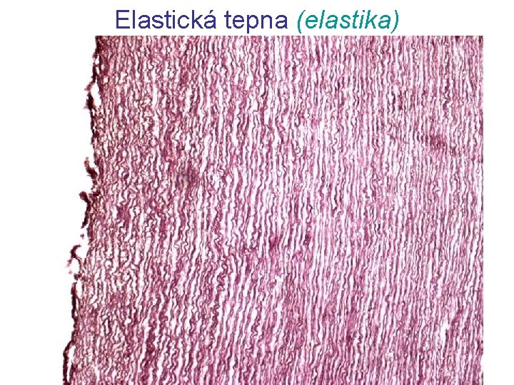 Elastická tepna (elastika) 