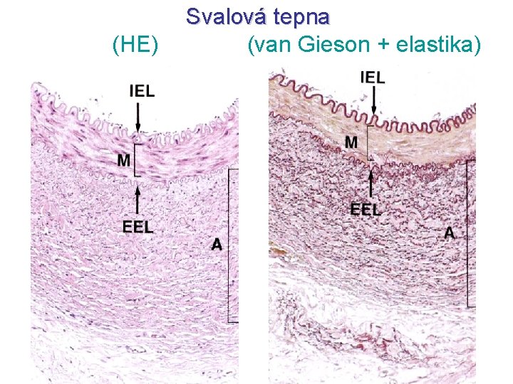 (HE) Svalová tepna (van Gieson + elastika) 