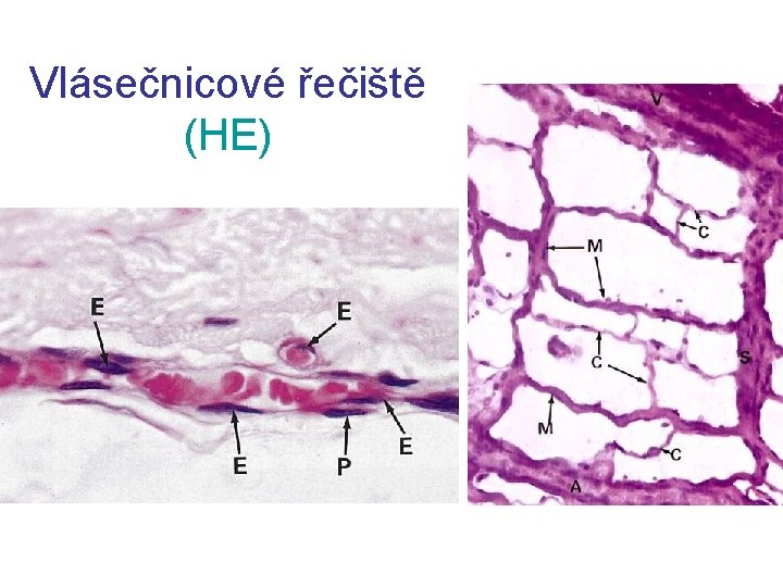Vlásečnicové řečiště (HE) 
