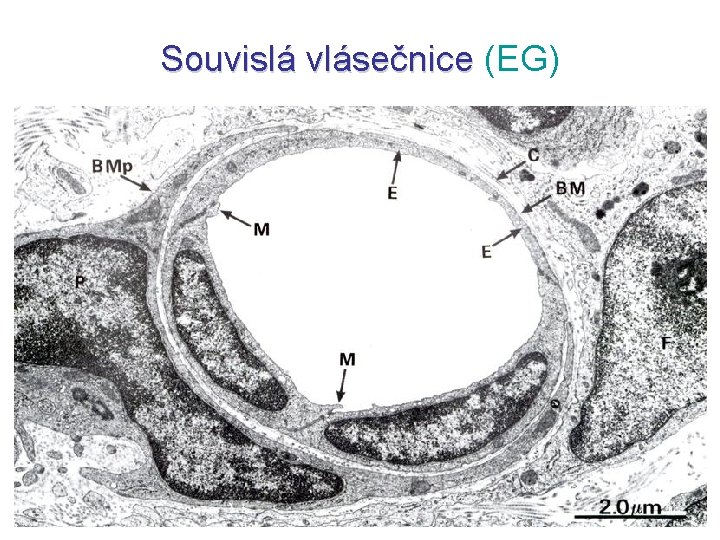 Souvislá vlásečnice (EG) 