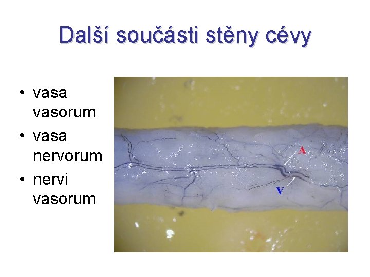 Další součásti stěny cévy • vasa vasorum • vasa nervorum • nervi vasorum 