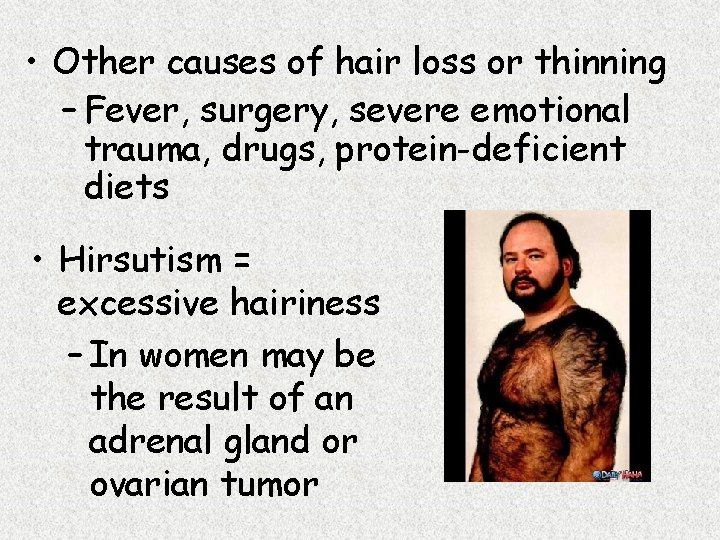  • Other causes of hair loss or thinning – Fever, surgery, severe emotional