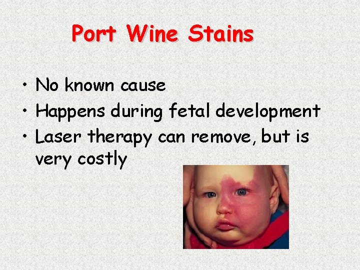 Port Wine Stains • No known cause • Happens during fetal development • Laser