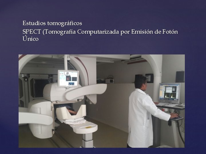 Estudios tomográficos SPECT (Tomografía Computarizada por Emisión de Fotón Único 