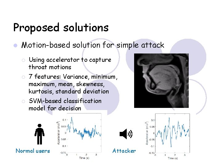 Proposed solutions Motion-based solution for simple attack Using accelerator to capture throat motions 7