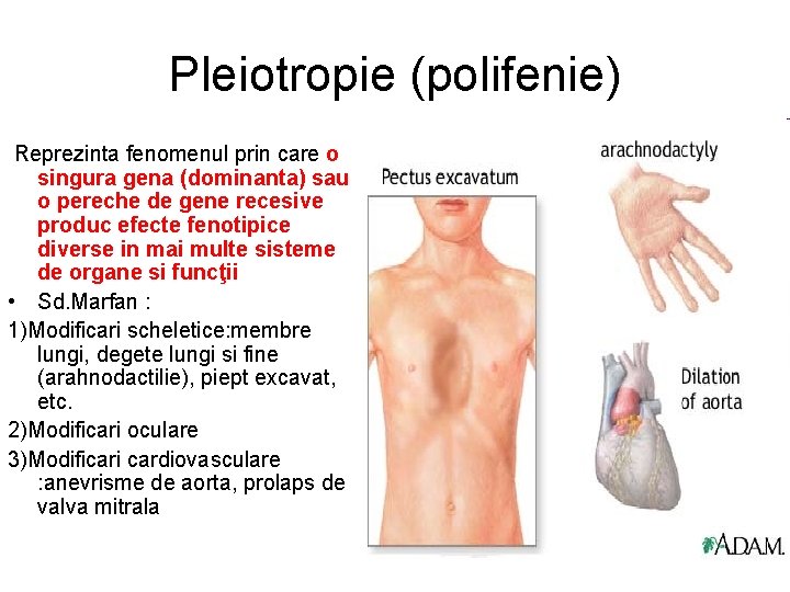 Pleiotropie (polifenie) Reprezinta fenomenul prin care o singura gena (dominanta) sau o pereche de