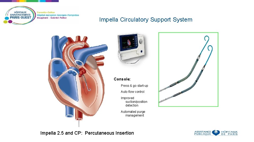 Impella Circulatory Support System Console: Press & go start-up Auto flow control Improved suction/position