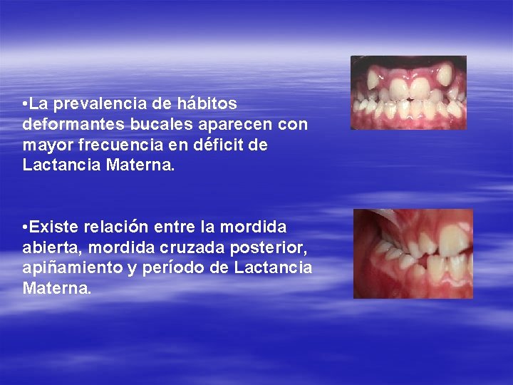  • La prevalencia de hábitos deformantes bucales aparecen con mayor frecuencia en déficit