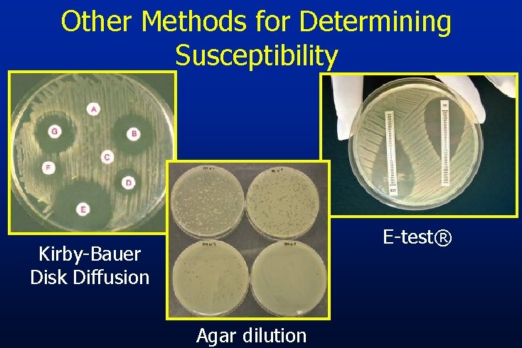 Other Methods for Determining Susceptibility E-test® Kirby-Bauer Disk Diffusion Agar dilution 