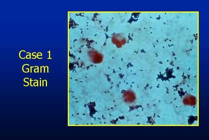 Case 1 Gram Stain 