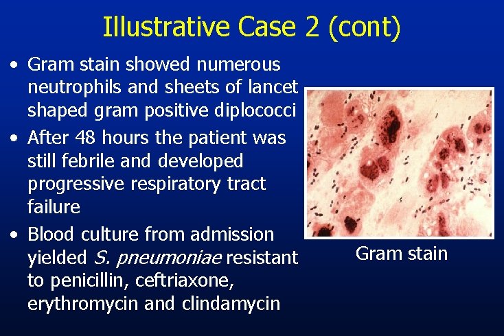 Illustrative Case 2 (cont) • Gram stain showed numerous neutrophils and sheets of lancet
