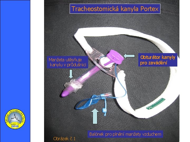 Tracheostomická kanyla Portex Manžeta utěsňuje kanylu v průdušnici Obrázek č. 1 Obturátor kanyly pro