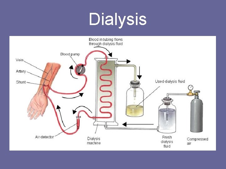 Dialysis 