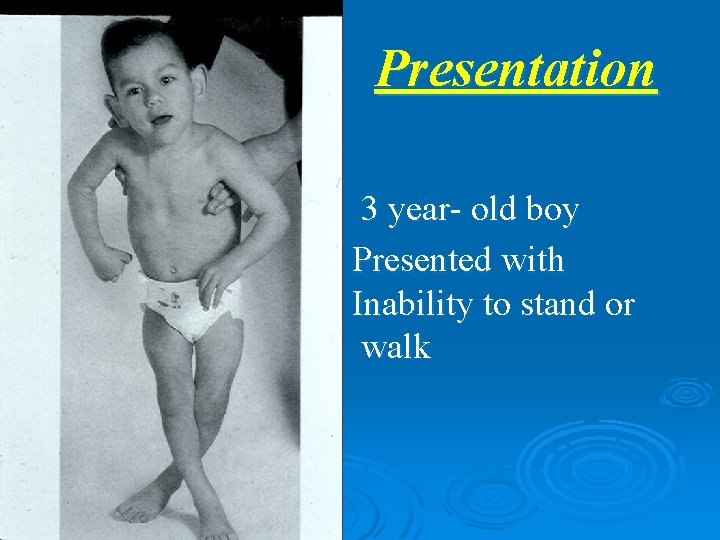 Presentation 3 year- old boy Presented with Inability to stand or walk 
