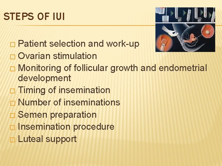 STEPS OF IUI � Patient selection and work-up � Ovarian stimulation � Monitoring of