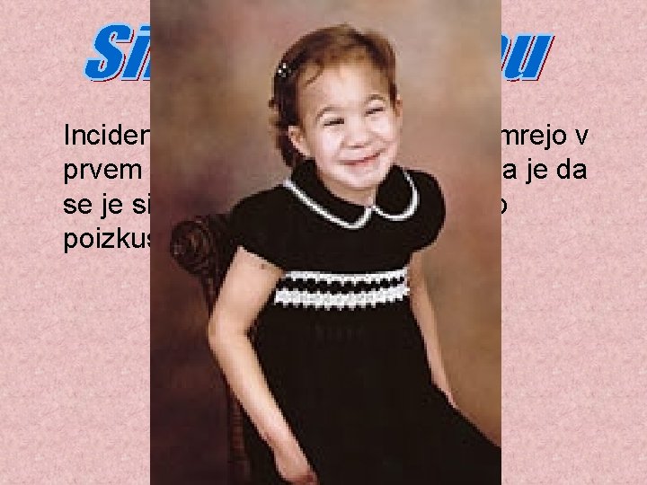 Incidenca je 1/15000. Večinoma umrejo v prvem mesecu po rojstvu, domneva je da se