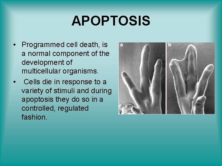 APOPTOSIS • Programmed cell death, is a normal component of the development of multicellular