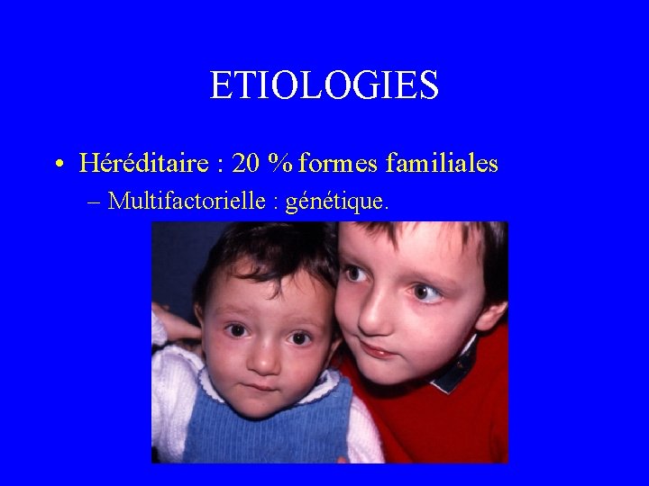 ETIOLOGIES • Héréditaire : 20 % formes familiales – Multifactorielle : génétique. 