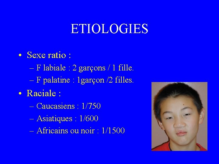 ETIOLOGIES • Sexe ratio : – F labiale : 2 garçons / 1 fille.