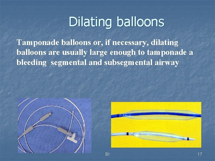 Dilating balloons Tamponade balloons or, if necessary, dilating balloons are usually large enough to