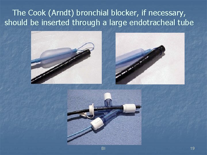 The Cook (Arndt) bronchial blocker, if necessary, should be inserted through a large endotracheal