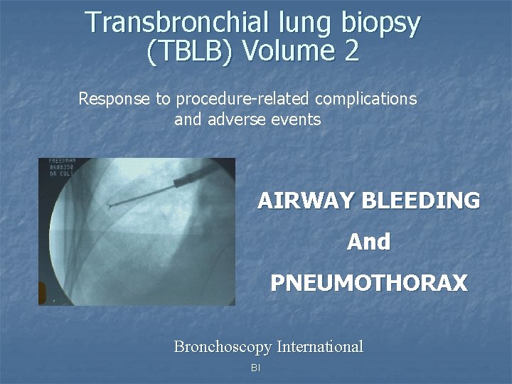 Transbronchial lung biopsy (TBLB) Volume 2 Response to procedure-related complications and adverse events AIRWAY