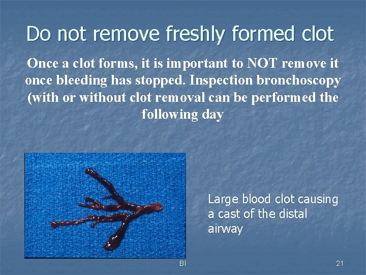 Do not remove freshly formed clot Once a clot forms, it is important to