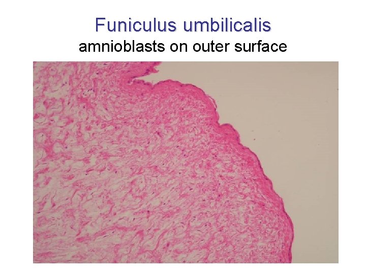 Funiculus umbilicalis amnioblasts on outer surface 