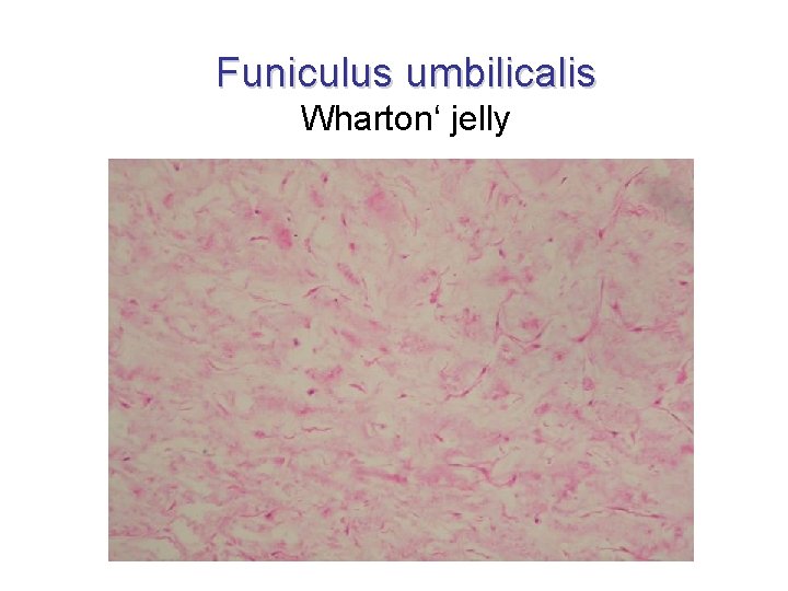 Funiculus umbilicalis Wharton‘ jelly 