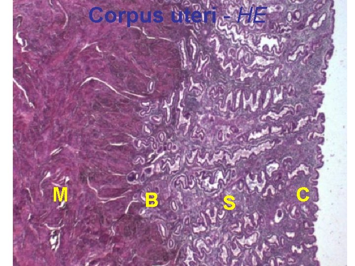 Corpus uteri - HE M B S C 