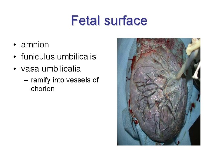 Fetal surface • amnion • funiculus umbilicalis • vasa umbilicalia – ramify into vessels