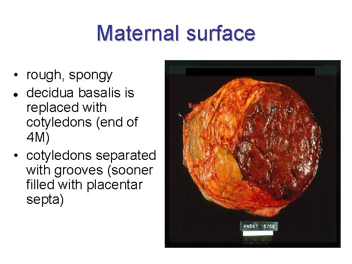 Maternal surface • rough, spongy decidua basalis is replaced with cotyledons (end of 4
