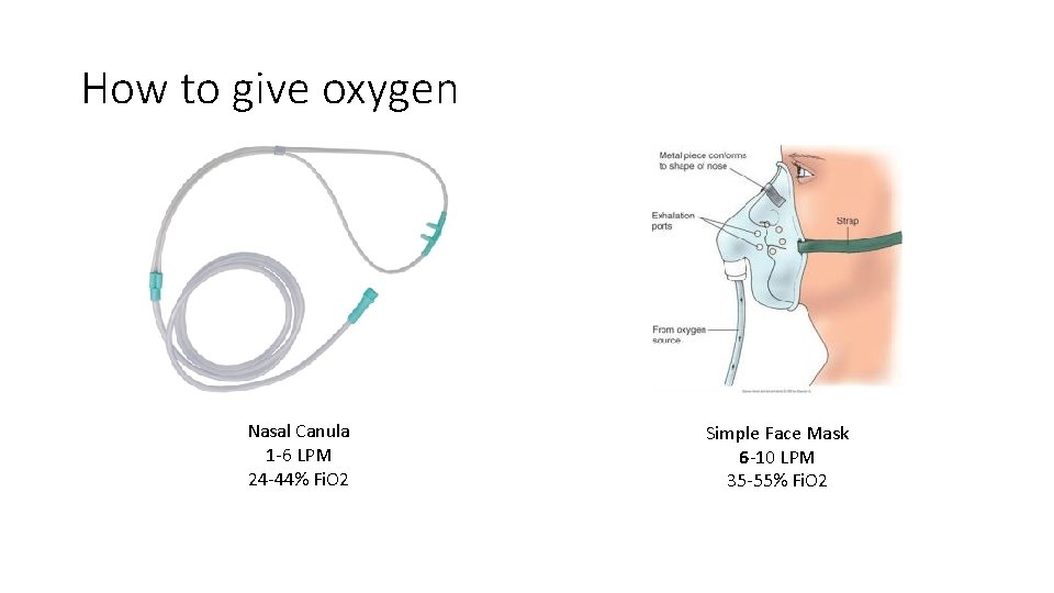 How to give oxygen Nasal Canula 1 -6 LPM 24 -44% Fi. O 2