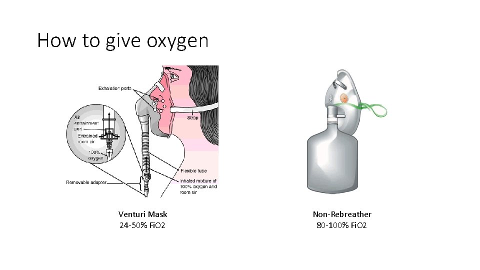 How to give oxygen Venturi Mask 24 -50% Fi. O 2 Non-Rebreather 80 -100%