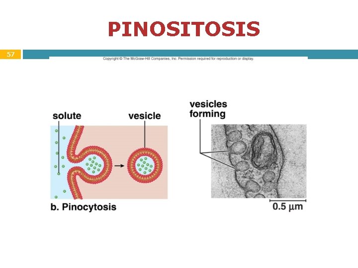 PINOSITOSIS 57 